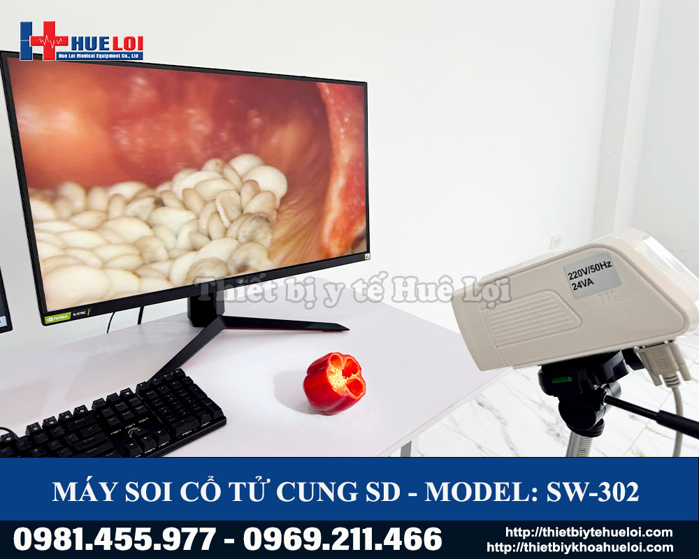Máy soi cổ tử cung SD SW-302 Sanwe Medical